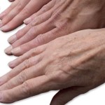 Aging Hands