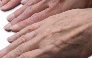 Why injury prevention is so important via The Strad